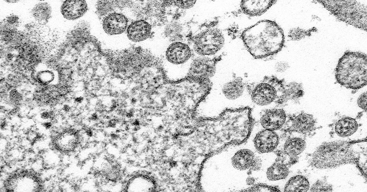 Coronavirus Covid 19 Assessment Information And Updates Nbme